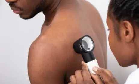 A clinician examining a patient’s skin with a dermatoscope
